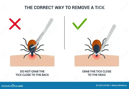 How to Remove a Tick