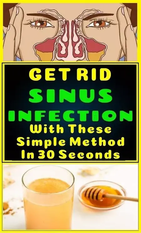 How to Get Rid of a Sinus Infection