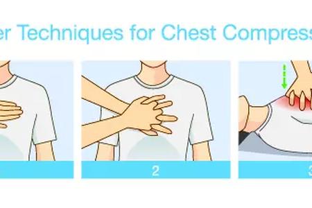 How to Perform Chest Compressions
