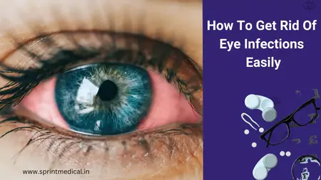 How to Get Rid of a Eye Infection