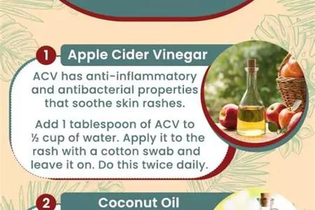 How to Get Rid of a Rash